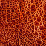 Для жителей Ялты открыта Школа сахарного диабета